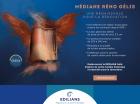 Nouvelle tuile Médiane Réno Gélis d’EDILIANS, l’alliée de votre projet de rénovation !